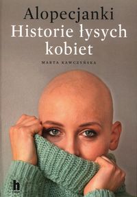 Alopecjanki. Historie łysych kobiet